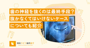 歯の神経を抜くのは最終手段？抜かなくてはいけないケースについても紹介