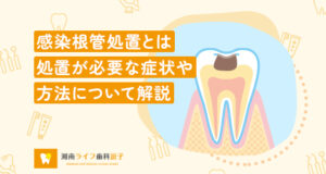 感染根管処置とは｜処置が必要な症状や方法について解説