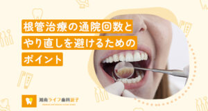根管治療の通院回数とやり直しを避けるためのポイント
