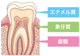 歯の神経を守る処置