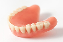 リテーナー型義歯