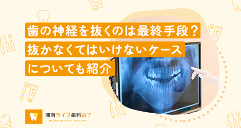 歯の神経を抜くのは最終手段？抜かなくてはいけないケースについても紹介