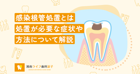 感染根管処置とは｜処置が必要な症状や方法について解説