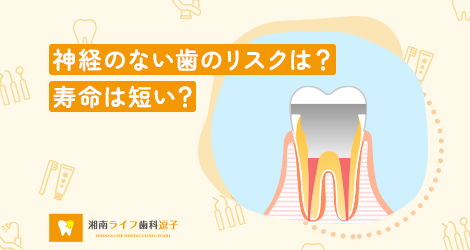 神経のない歯のリスクは？寿命は短い？