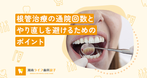 根管治療の通院回数とやり直しを避けるためのポイント